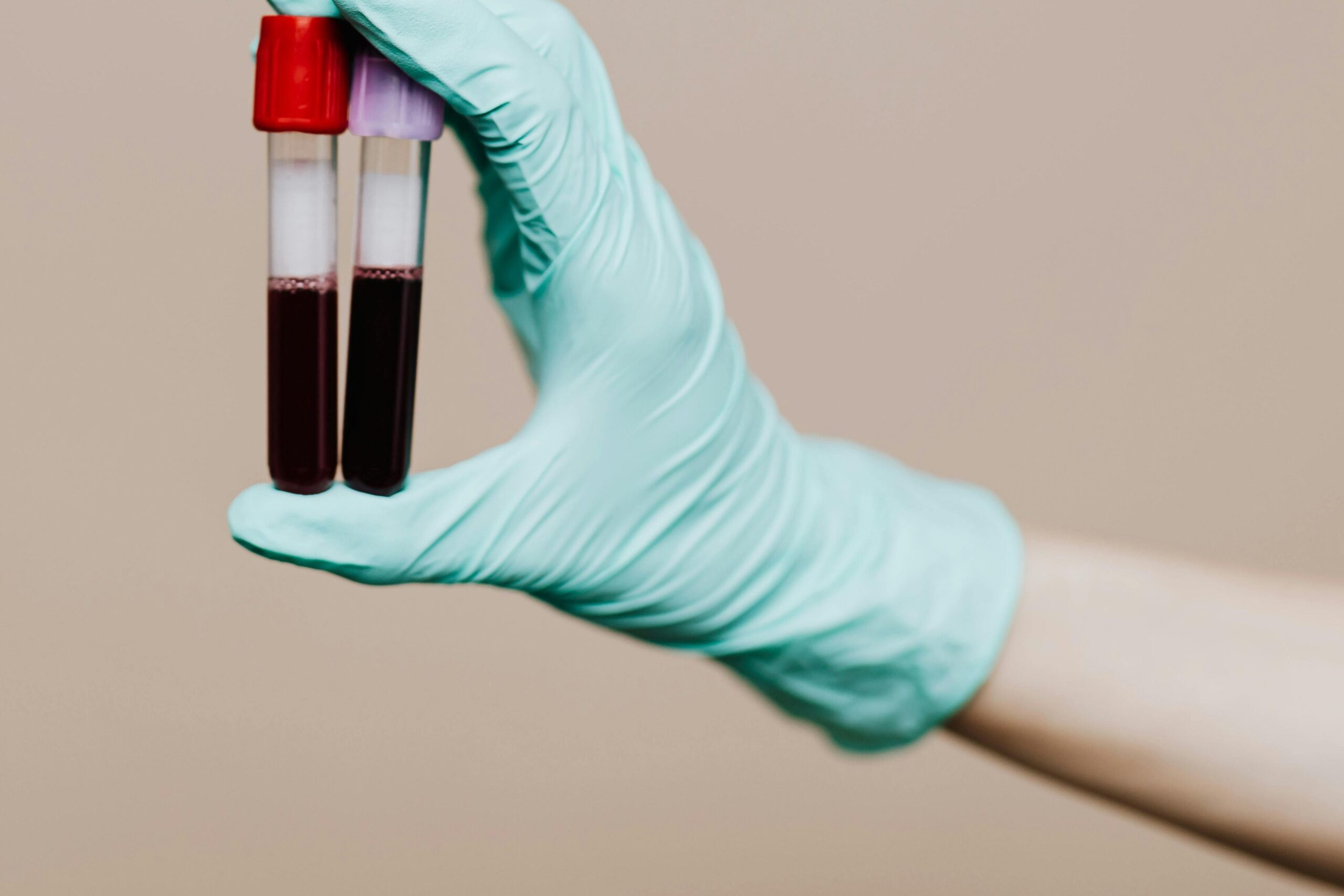 Close-up of a gloved hand holding two blood sample tubes in a laboratory setting.